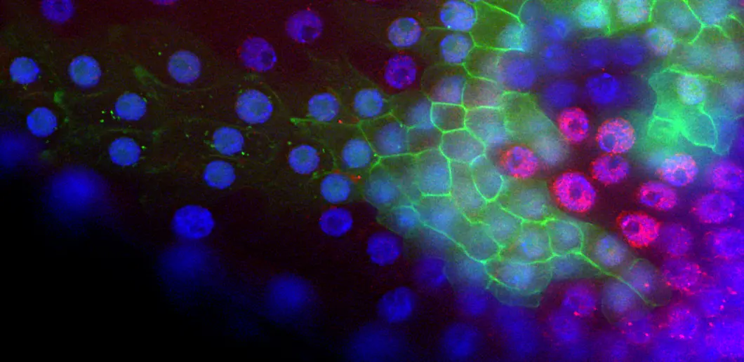 Fluorescence microscopy image of genetically mosaic Drosophila tissue